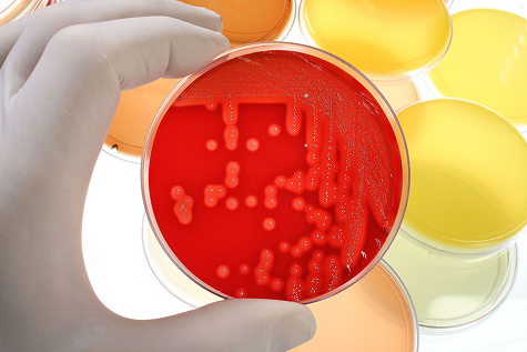 Microbiological analysis and results interpretation